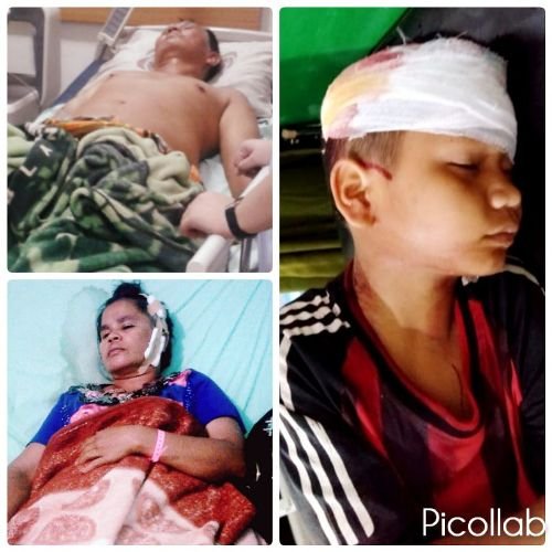 Dibacok Lima Pria Bertopeng, Pensiunan Polri Sekeluarga Nyaris Tewas